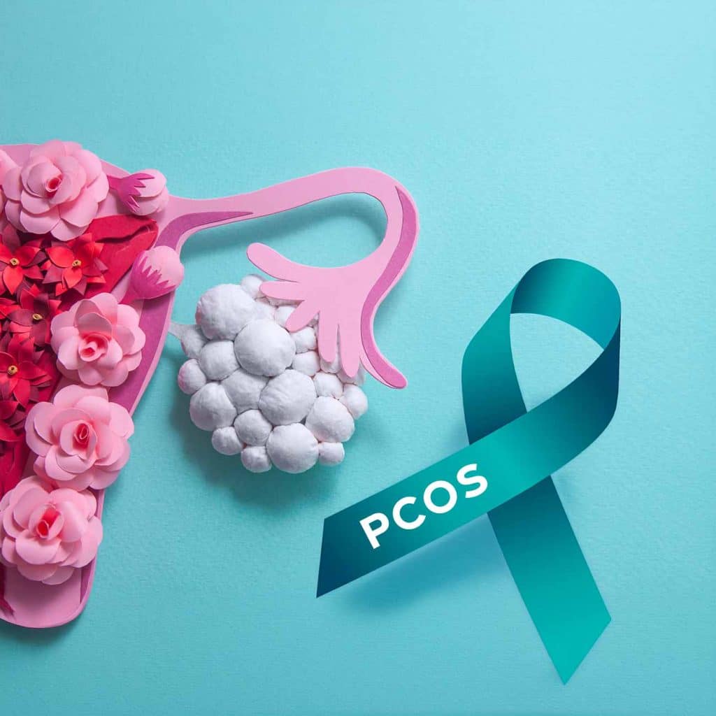 A teal ribbon labeled PCOS is next to an artistic representation of ovaries, with one ovary decorated with white cotton balls and pink flowers, symbolizing women’s health and polycystic ovary syndrome awareness.